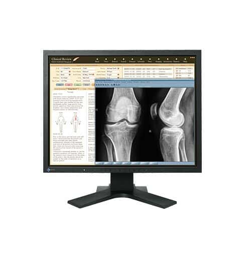 نمایشگر پزشکی Medical LED، LCD ایزو RadiForce MX21055743
