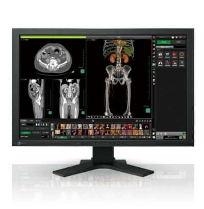 نمایشگر پزشکی Medical LED، LCD ایزو RadiForce MX241W55751