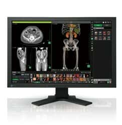 نمایشگر پزشکی Medical LED، LCD ایزو RadiForce MX241W55751thumbnail
