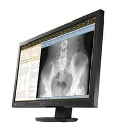 نمایشگر پزشکی Medical LED، LCD ایزو RadiForce MS230W55770thumbnail