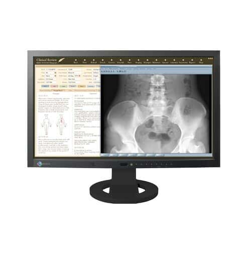 نمایشگر پزشکی Medical LED، LCD ایزو RadiForce MS230W55769